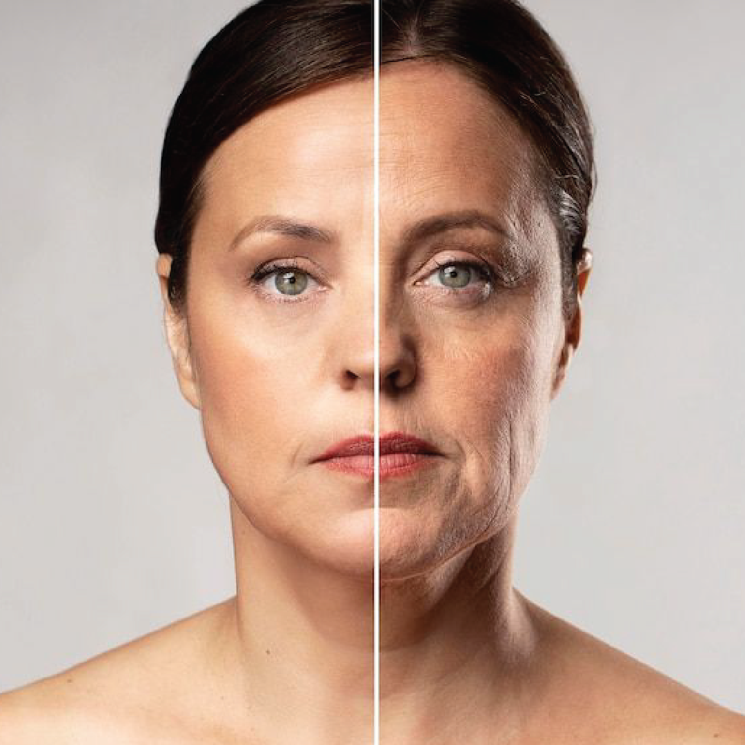 Wrinkles treatments