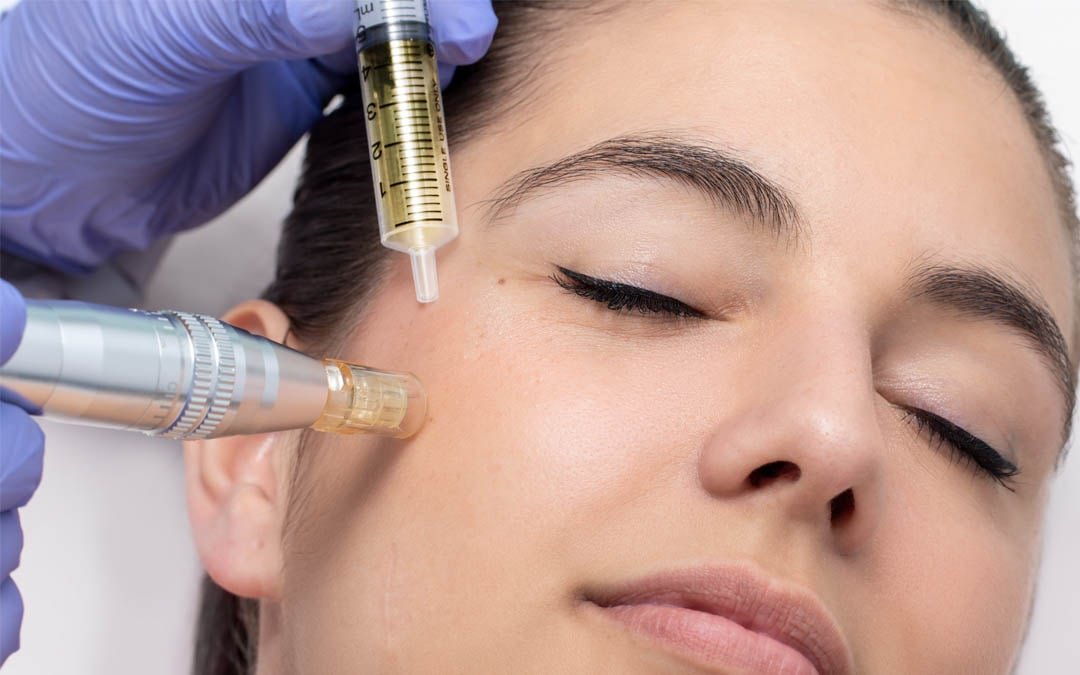 Exosomes treatment
